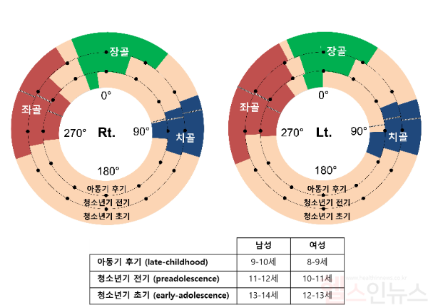 연령에 따른 2차골화중심의 형성 부위. 비구 테두리를 따라 나타난 장골·치골·좌골의 2차골화중심은 연령이 증가할수록 형성 부위가 점차 넓어지며, 성장 종료 후 완전히 연결될 것으로 예측됨 (서울대학교병원 제공)