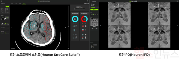 휴런, 대만 FDA 2개 추가 획득 ‘대만 진출 가속화’ (휴런 제공)