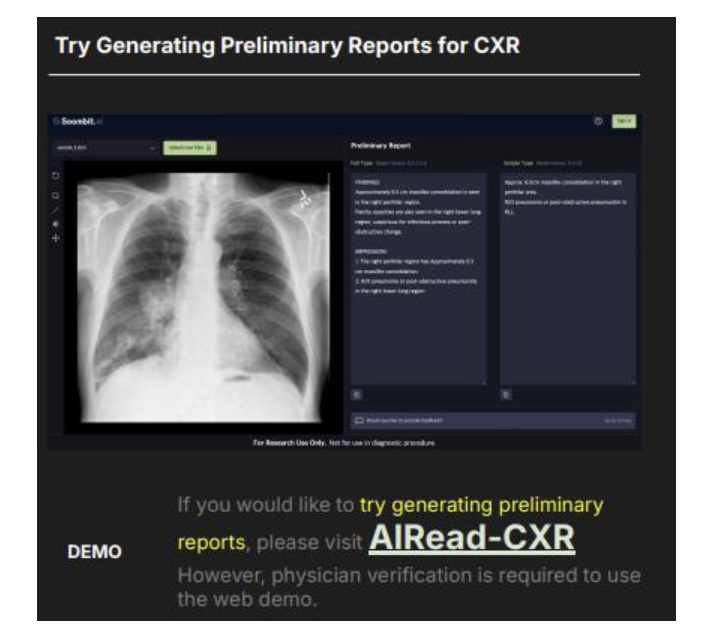 AIRead-CXR 웹 데모(숨빗AI 자료 캡처=연합 제공)