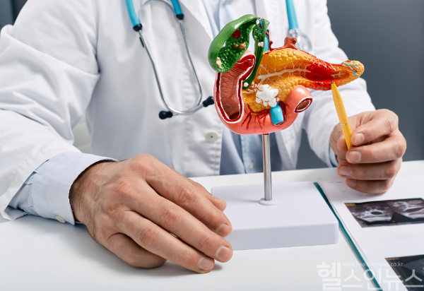 췌장암 환자들의 항암치료 후 근육량 보존이 생존율에 지대한 영향을 미칠 수 있다는 연구 결과가 발표됐다. (클립아트코리아)