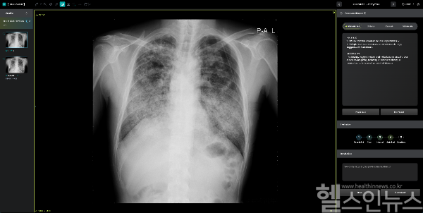 딥젠 적용 화면 (딥노이드 제공)