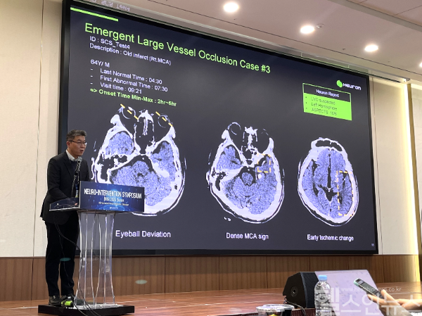 휴런, NIS 2025 참가해 ‘뇌졸중 치료 시작시간 단축’ 알려 (휴런 제공)