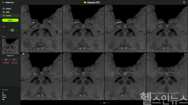 휴런, 파킨슨병 AI 솔루션 ‘휴런IPD’, 싱가포르 인허가 획득 (㈜휴런 제공)