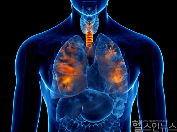 감기, 독감 등에 걸렸던 환자들은 그 합병증으로 폐렴에 걸리기 쉬운 편이다. 의심 증상이 있다면 즉시 병원에 방문해 현명하게 대처해야 한다. (클립아트코리아)