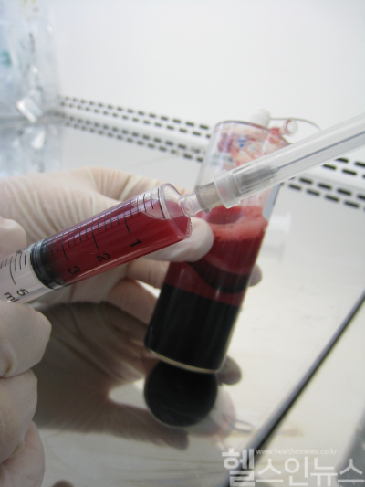 혈소판이 농축된 PRP 주사 (연세사랑병원 제공)