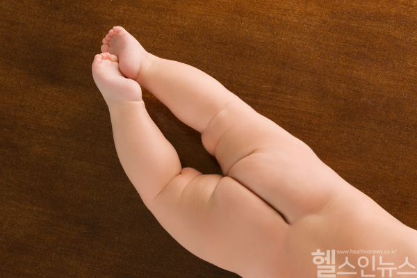 신생아 중 약 5% 정도에게 발견된다는 엉덩이 보조개 '딤플'. 이는 단순 피부 함몰인 경우가 많지만 척수이형성증과도 관련이 있을 수 있어 증상에 맞는 적극적 대처가 필요하다. (클립아트코리아)