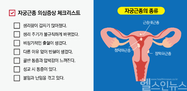 ‘자궁근종 의심증상 체크리스트’ 및 자궁근종의 종류‘ (순천향대 부천병원 제공)
