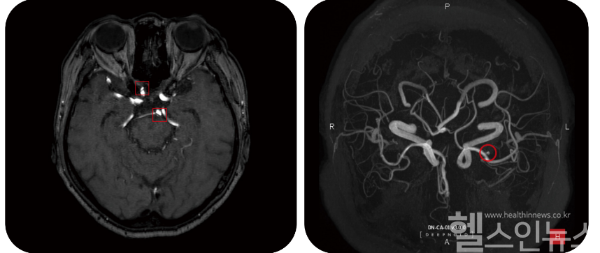 딥뉴로 판독화면 (딥노이드 제공)