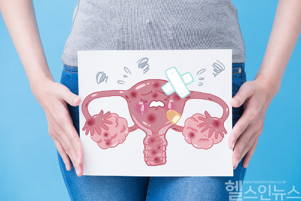 국내 한 통계자료에 따르면 15~34세 여성의 자궁경부암 발생률이 지속적인 증가 추세를 보이고 있어 주의가 요구된다. 자궁경부암은 정기적인 검진과 백신 접종으로 예방할 수 있다. (클립아트코리아)