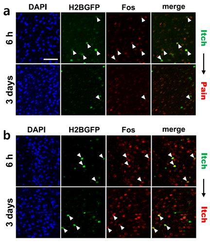 통증과 가려움 자극에 의해 활성화된 뉴런의 시각화(사진=기초과학연구원)