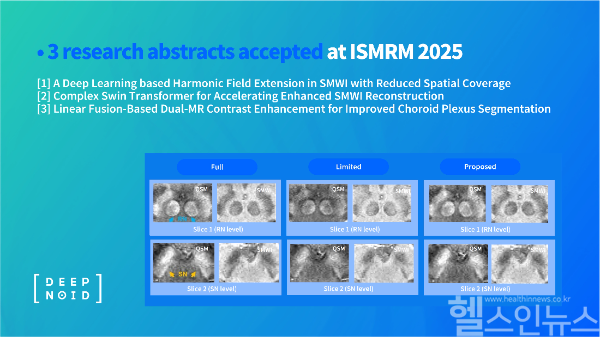 ISMRM 2025 연구 초록 채택 (딥노이드 제공)
