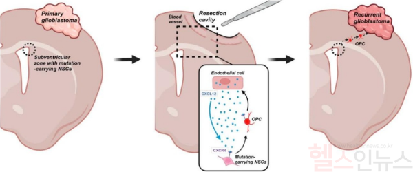 교모세포종 재발 매커니즘 모식도: 초발 교모세포종(왼쪽)에서는 암 유발 원인인 돌연변이 유전자를 가진 신경줄기세포가 뇌 깊은 곳에서 위치함. 초발 종양을 수술로 제거해도(중앙) 혈관내피세포가 분비하는 신호가 신경줄기세포를 자극하여 재발 부위로 이동을 촉진함. 재발 교모세포종(오른쪽)에서는 이동한 신경줄기세포가 재발암을 형성함. (서울대병원 제공)