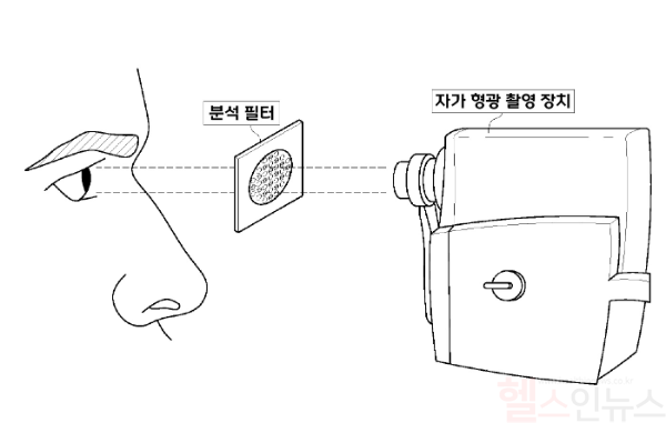 분석 필터를 활용해 자가 형광 신호를 촬영함으로써 수정체 이상 여부를 객관적으로 평가할 수 있다. (고대안산병원 제공)