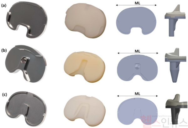 경골 삽입 구성 요소의 각기 다른 디자인 락킹 메커니즘 설계 (연세사랑병원 제공)
