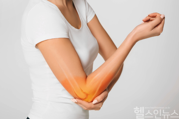 팔꿈치 통증과 저림 증상이 경추 신경병증으로 인한 방사통일 수 있으며, 정확한 진단과 조기 치료가 중요하다. (클립아트코리아)