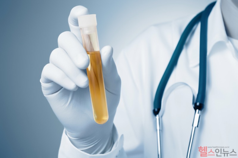 거품뇨가 단백뇨일 수는 있지만 항상 그런 건 아니다. 단, 소변에 거품이 지속적으로 많이 생긴다면 소변 검사를 받아보는 것이 좋다. (클립아트코리아)