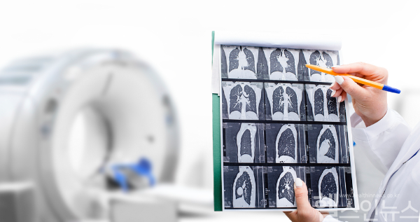 지난해 결핵환자 수는 8.2% 감소한 1만7944명으로, 고령층과 외국인 환자 비중이 증가하며, 질병관리청은 결핵 예방과 관리 강화를 위한 다양한 정책을 추진하고 있다. (클립아트코리아)