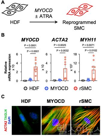 A.피부나 장기에서 흔히 볼 수 있는 섬유아세포를 마이오카딘과 올트랜스레티노익산을 이용해 평활근세포로의 직접교차분석리프로그래밍법 개발. B.직접리프로그래밍된 평활근세포(rSMC)에서 대조군과 비교해 평활근세포 특이적 유전자 발현의 증가를 확인했다. C.rSMC에서 평활근세포 특이적 단백질 발현이 확인됐다. (세브란스병원 제공)