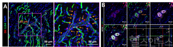 A.조직 내 세포 추적을 통해 rSMC(red)가 혈관(green)벽 안으로 정착하는 능력 확인해 rSMCs가 단순히 모양만 비슷한 것이 아니라, 실제로 혈관 벽에서 평활근세포로서 역할을 수행할 수 있는 것을 확인했다. B. 조직 내 세포 추적을 통해 rSMC(red)가 세동맥의 혈관 벽(white)안으로 정착하는 능력을 확인했다. (세브란스병원 제공)