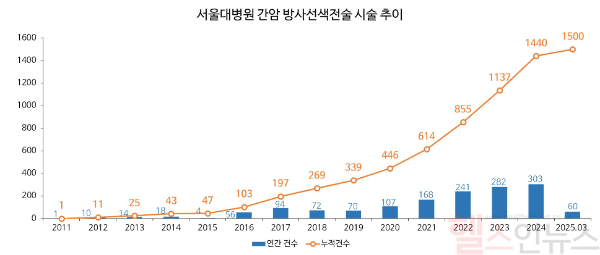 서울대병원 간암 방사선색전술 시술 추이 (서울대병원 제공)