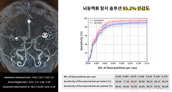 제이엘케이, 뇌동맥류 탐지 솔루션 95.2% 민감도, 낮은 오탐지율 국제저널에 발표 "다기관 임상 연구 통해 높은 정확도 입증" (제이엘케이 제공)