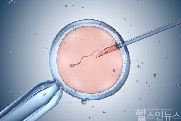 시험관아기 시술과 인공수정은 난임 치료에서 성공률과 방법에 따라 선택이 달라지며, 개인별 상황에 맞는 최적의 치료가 중요하다. (클립아트코리아)