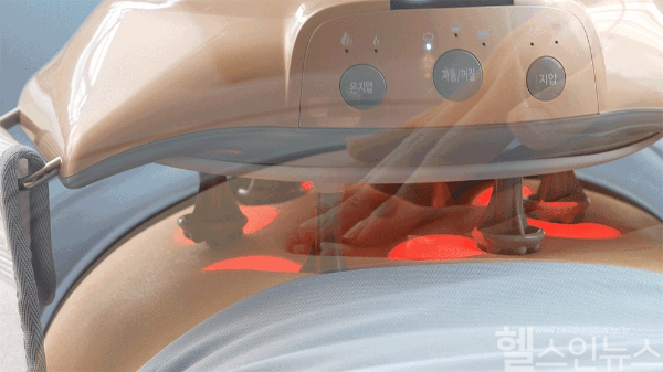 쉬안, 장운동 복부지압 마사지기 할인 프로모션 진행 (쉬안 제공)