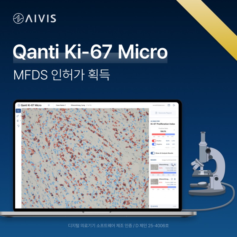 에이비스, 현미경 기반 형태 계측 솔루션 ‘콴티 Ki-67 Micro’ 디지털의료기기 허가 획득