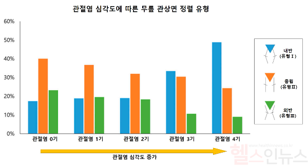 관절염 심각도에 따른 무릎 관상면 정렬 유형. 관절염 0~2기에는 유형Ⅱ(중립 정렬)이 가장 흔했지만, 관절염이 심각해질수록 유형Ⅰ(내반 정렬) 비율이 증가했다. (서울대병원 제공)