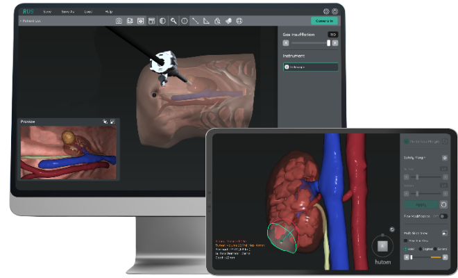 RUS NE(Kidney) 3D 입체 가장 화면 이미지 ⓒ휴톰
