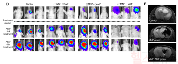 동물실험에서 영상조영능력 및 치료효과 규명: (D) (+)MNP(나노물질),(+)AMF 실험군이 대조군보다 영상조영능력 및 치료효과가 큼 (E) MRI에서 뇌암 위치와 이동경로를 정확하게 파악 가능 (서울대병원 제공)