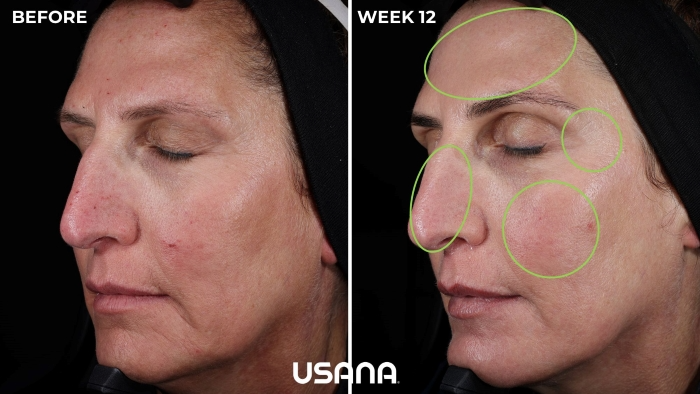 유사나헬스사이언스, 셀라비브 리서페이싱 앰플 세럼 임상 결과 공개...‘2주 피부 변화’ 입증