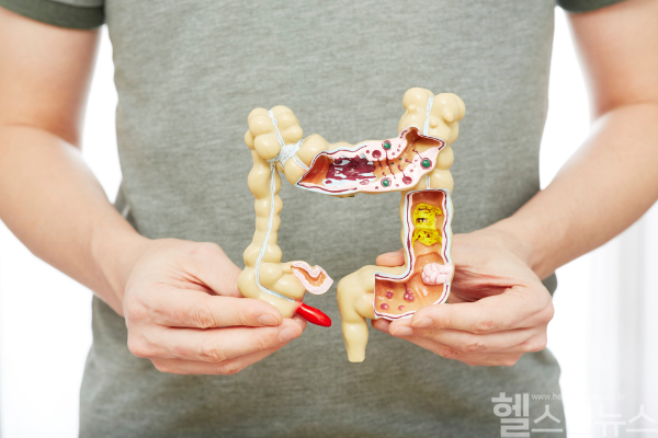 염증성장질환 환자 절반 이상이 치료 중에도 증상을 겪고 있으며, 치료 만족도는 증상 완화와 의료진과의 소통, 맞춤형 치료제 선택에 따라 크게 달라지는 것으로 나타났다. (클립아트코리아)