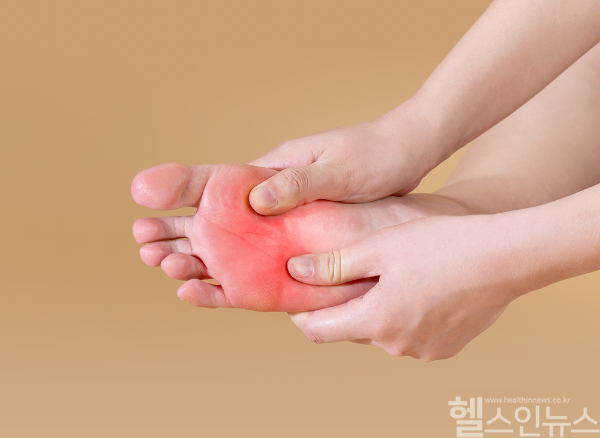 봄철 야외 활동 증가로 전염성 피부질환인 사마귀 감염 위험이 높아지며, 정확한 진단과 조기 치료가 중요하다. (클립아트코리아)