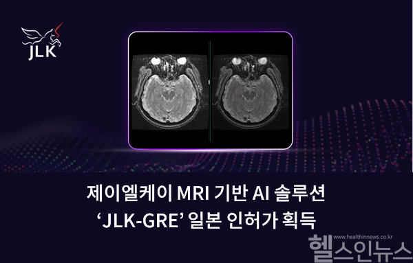 제이엘케이, MRI 기반 AI 솔루션 'JLK-GRE' 일본 인허가 획득 (제이엘케이 제공)