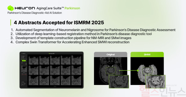 휴런, ISMRM 2025서 파킨슨병 진단 연구 4편 공개 (휴런 제공)