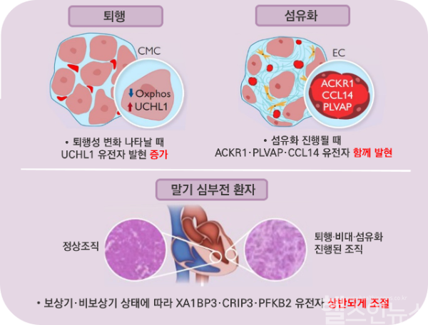 희귀·난치성 심근병증, 발병 단계·조직 손상 따라 달라지는 유전자 규명 (서울아산병원 제공)