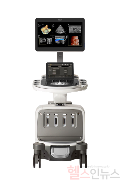 필립스 고사양 초음파 시스템 에픽 엘리트(EPIQ Elite) (필립스 제공)