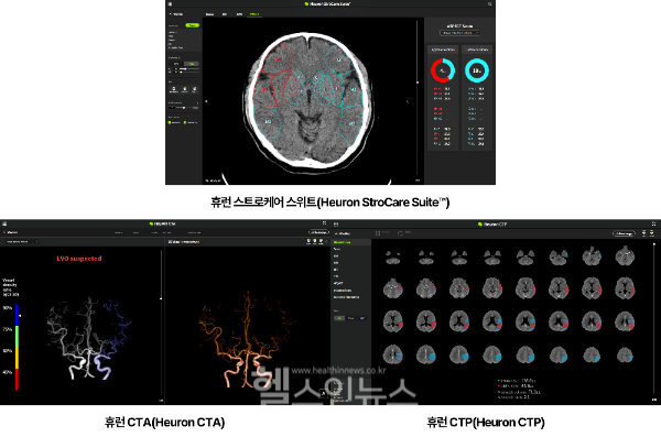 휴런, 모든 뇌졸중 CT 검사 솔루션 ‘상용화 성공’ (휴런 제공)