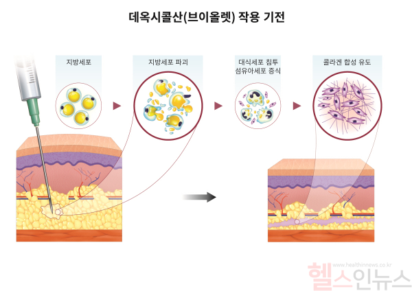 데옥시콜산 작용 기전 (대웅제약 제공)