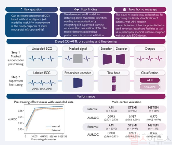 VUNO Med®-DeepECG® AMI 알고리즘 기반 연구 (뷰노 제공)
