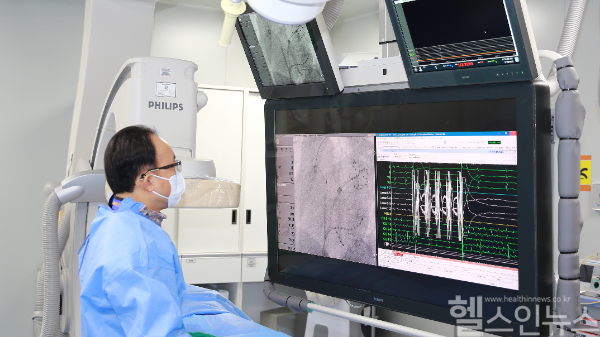 ‘펄스장 절제술’ 심방세동 시술 사진 (대구가톨릭대학교병원 제공)