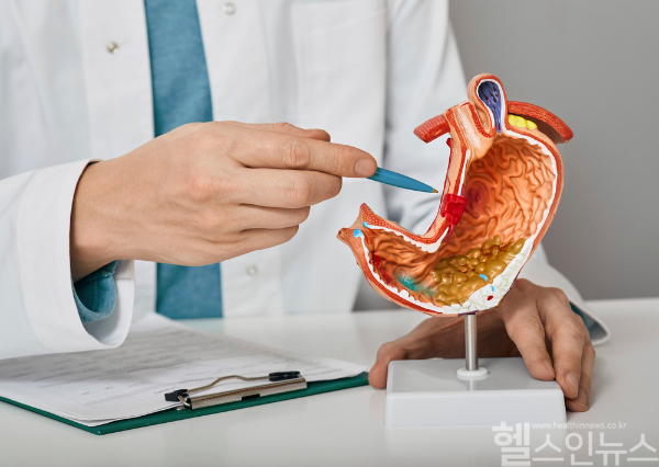 위암은 초기 증상이 거의 없어 정기적인 내시경 검진을 통한 조기 발견이 생존율을 높이는 핵심이다. (클립아트코리아)