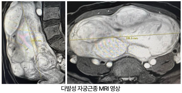 사진제공=서울하이케어의원