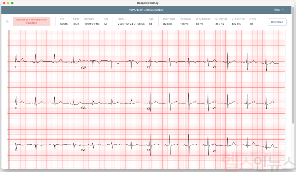 VUNO Med®-DeepECG® Kidney 운영화면 예시 (뷰노 제공)