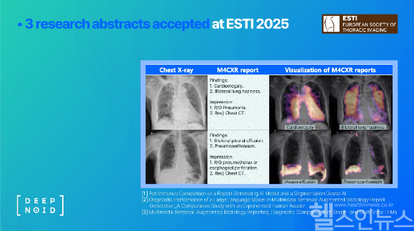 M4CXR 리포트 생성 예시 (딥노이드 제공)