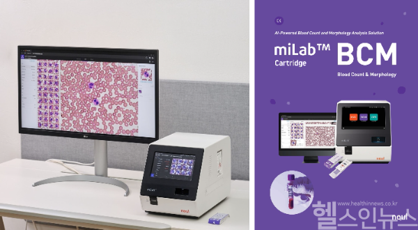 노을의 AI 기반 혈액분석 솔루션 miLab BCM (노을 제공)