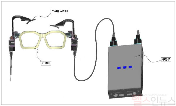 눈꺼풀 움직임 보조 장치의 구성도 (고대안산병원 제공)