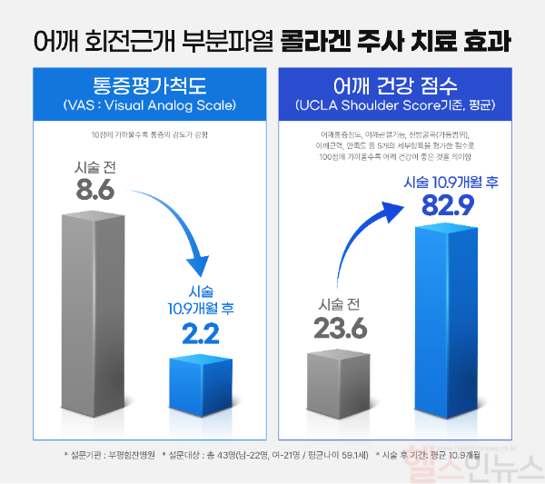 어깨 회전근개 부분파열 콜라겐 주사 치료 효과 (힘찬병원 제공)