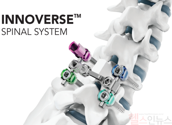 시지메드텍의 척추 고정 장치 ‘이노버스 스파이널 시스템(INNOVERSE Spinal System)’ (시지메드텍 제공)